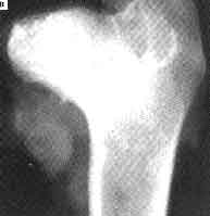 Legg-Perthes is mostly found in Toy breeds.