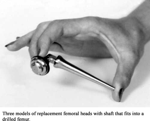 Three models of replacement femoral heads with shaft that fits into a drilled femur.