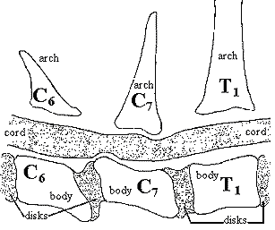 WOBBLER SYNDROME (CVI) IN DOGS